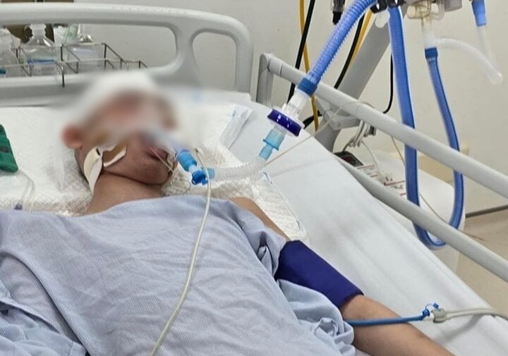 Vụ nam sinh lớp 8 ở Hà Nội bị đánh chết não: Vai trò bố bị can thế nào?- Ảnh 1.