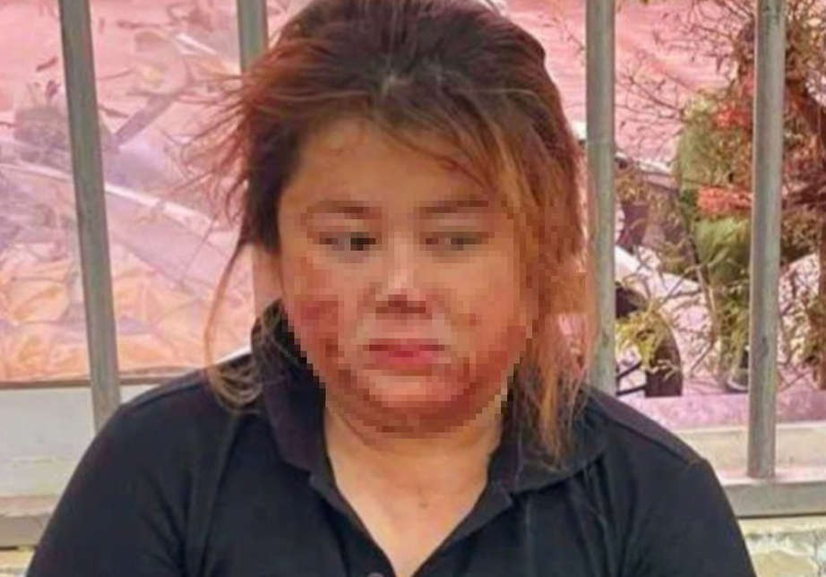 Kẻ đâm chồng hờ thủng tim, tử vong từng hành hung khiến bạn trai cũ hỏng một mắt- Ảnh 1. Kẻ đâm chồng hờ thủng tim, tử vong từng hành hung khiến bạn trai cũ hỏng một mắt- Ảnh 1.